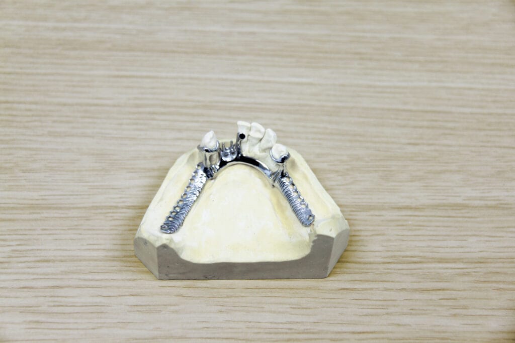 Tandtechniek in Reusel